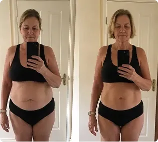 Patricia W. before and after