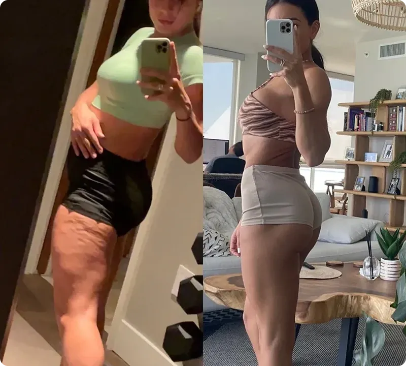 Jennifer L. before and after