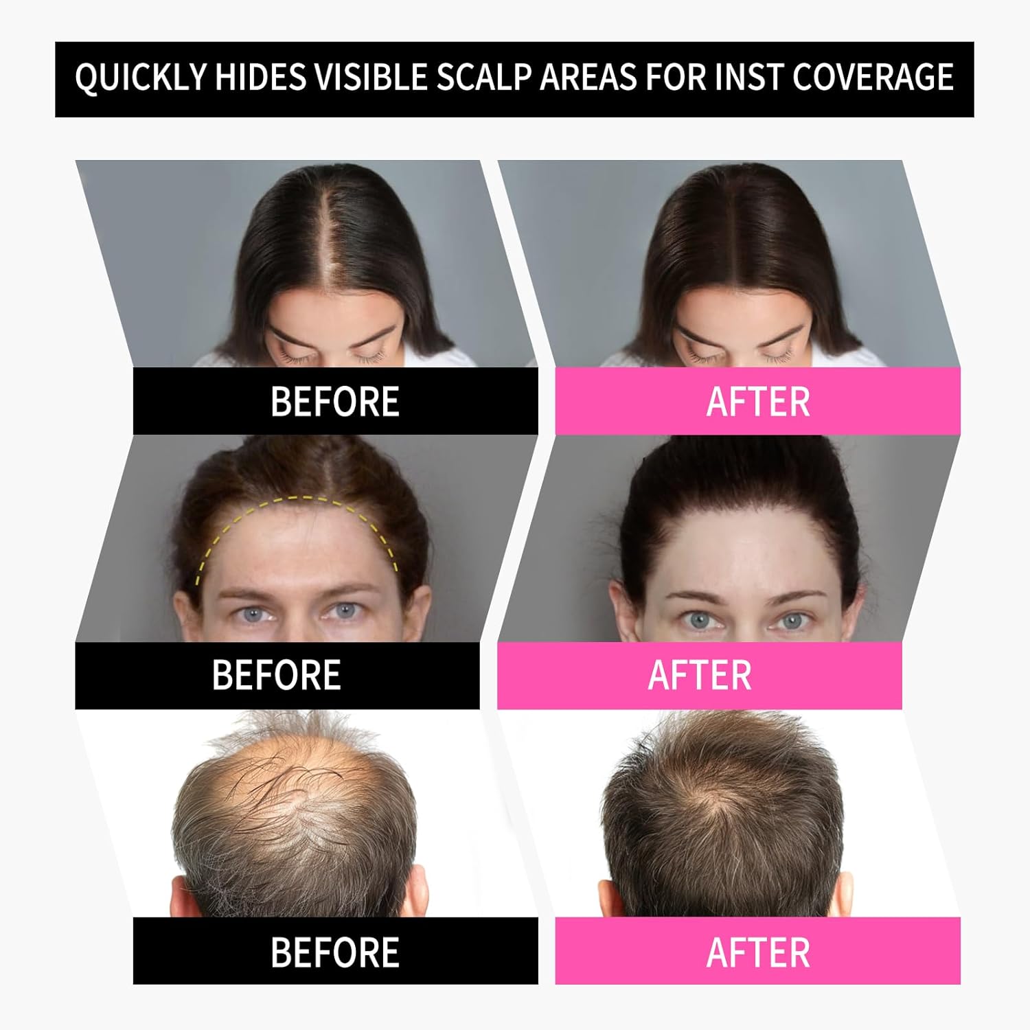 Sevich Hairline Powder，Instantly Conceals Hair Loss, Root Touch up Powder, Hair Shadow Toppers for Women & Men, Touch Up for Thinning Gray Hair, Windproof & Sweatproof, Dark Brown