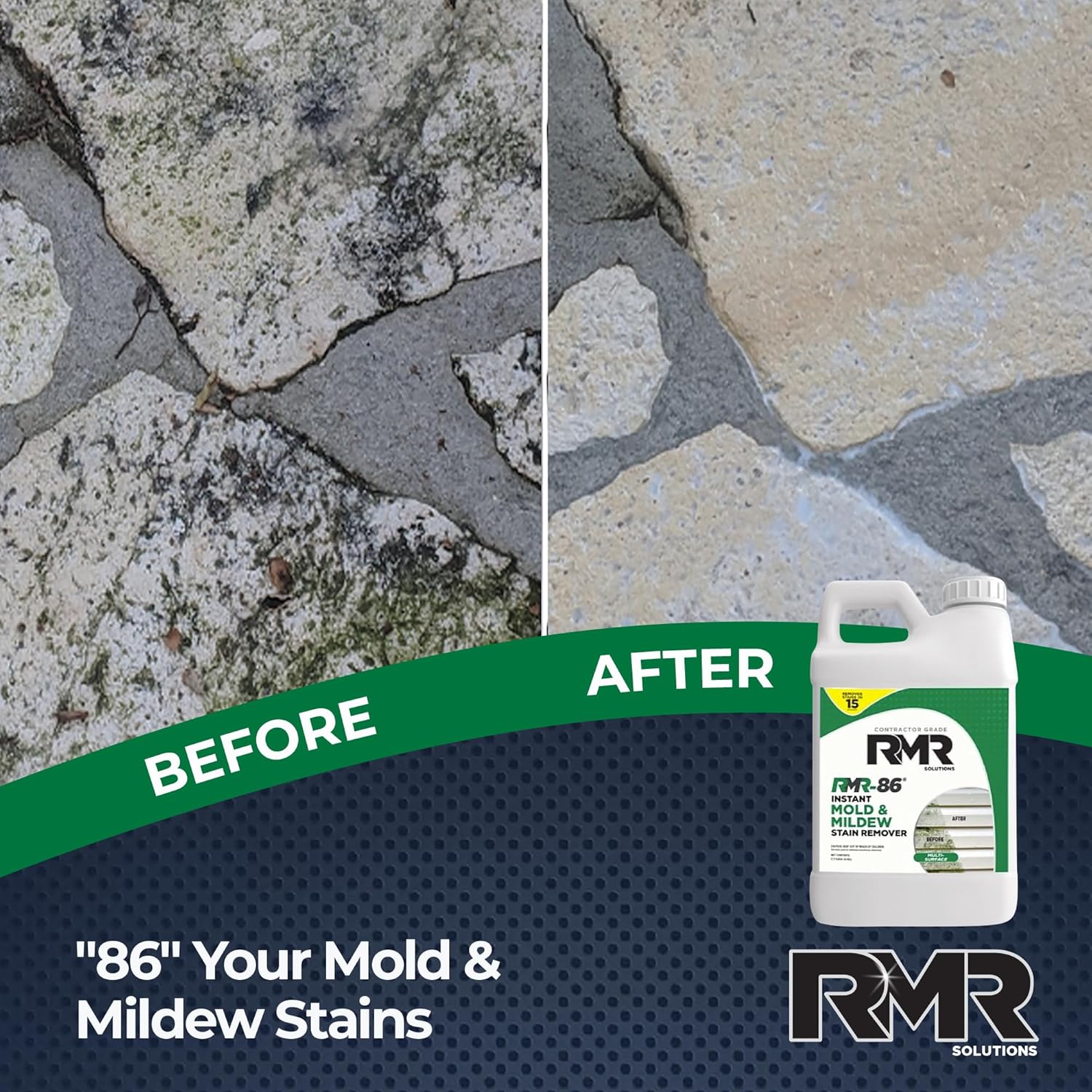 RMR-86 Instant Mold and Mildew Stain Remover Spray - Scrub Free Formula, 32 Fl Oz