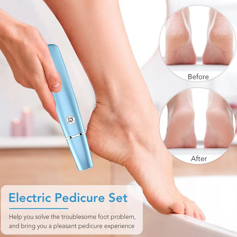 💥Limited time Offer 49%OFF🔥⚡Electric Feet Callus Remover