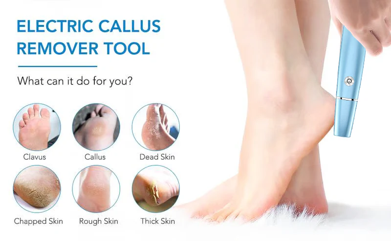 💥Limited time Offer 49%OFF🔥⚡Electric Feet Callus Remover