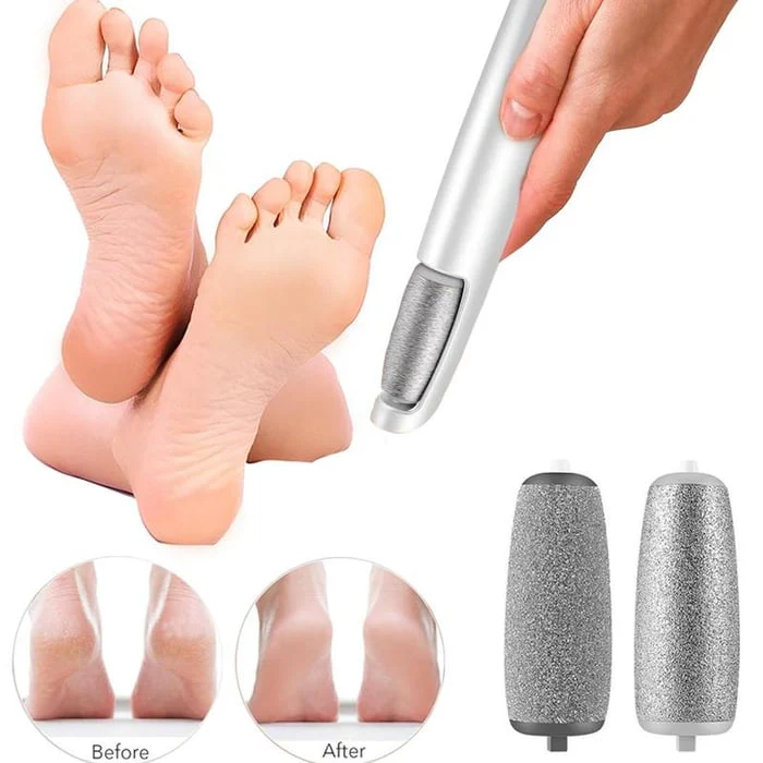 💥Limited time Offer 49%OFF🔥⚡Electric Feet Callus Remover