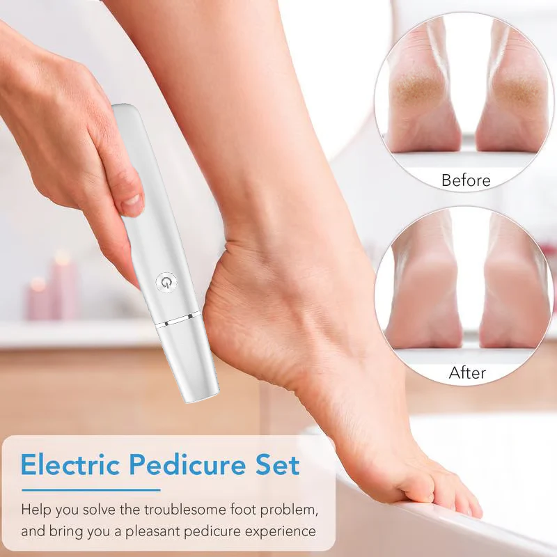 š„Limited time Offer 49%OFFš„ā”Electric Feet Callus Remover