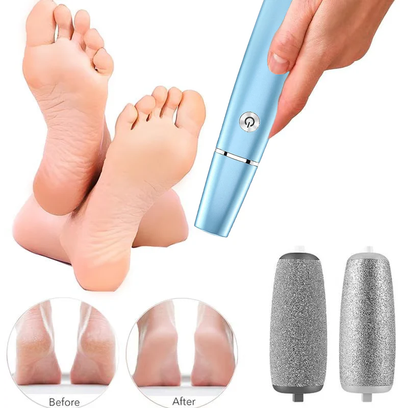 š„Limited time Offer 49%OFFš„ā”Electric Feet Callus Remover