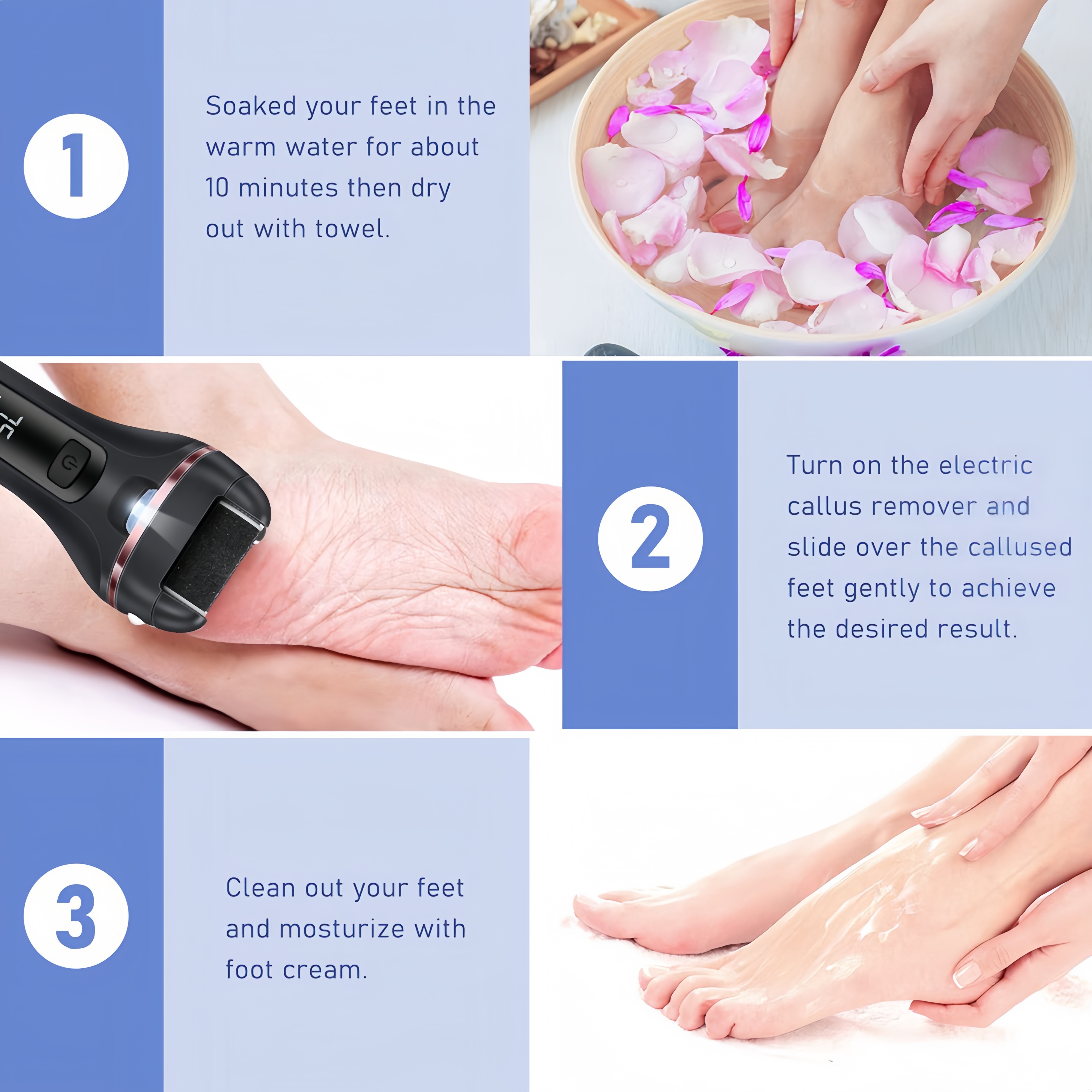 ✨ Electric Callus Remover – Smooth Feet in Seconds | 3 Rollers, LED Light, USB Rechargeable