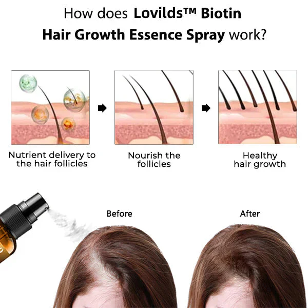 (🔥LAST DAY SALE-50% OFF) Lovilds™ Biotin Premium Hair Growth Serum