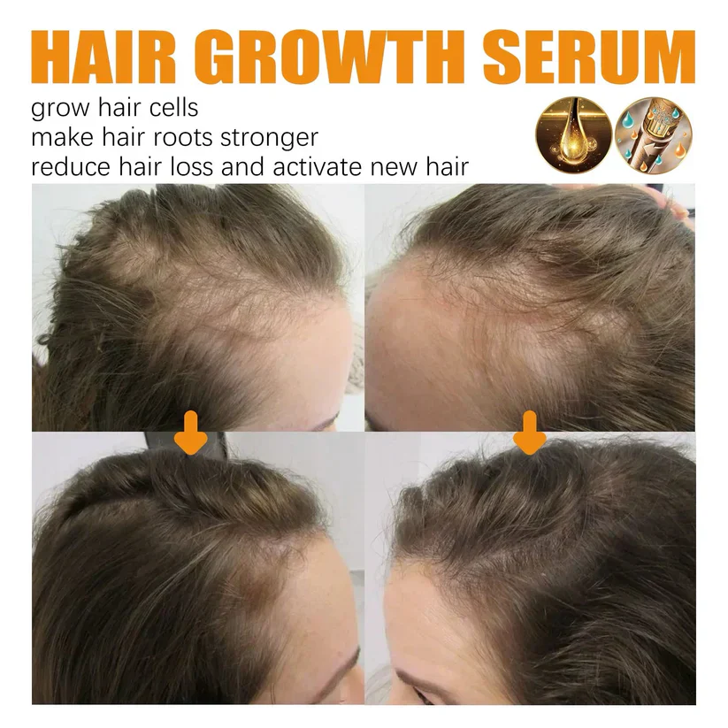 (🔥LAST DAY SALE-50% OFF) Lovilds™ Biotin Premium Hair Growth Serum