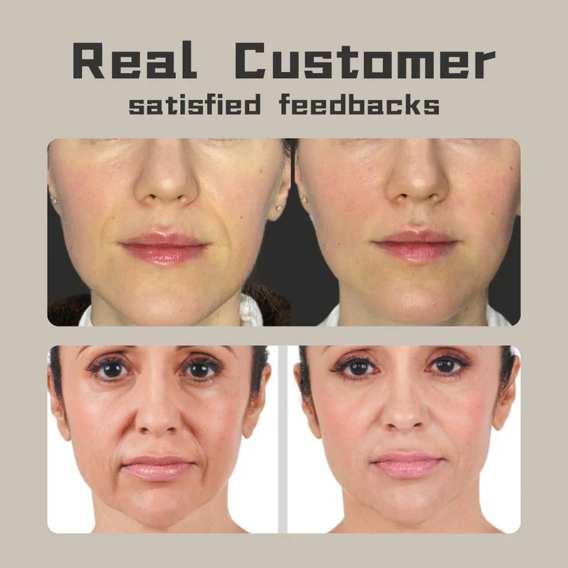 Revolutionary Anti-Aging Tech】BBOJI™ Facial Mask. Zeroing in on Nasolabial Lines