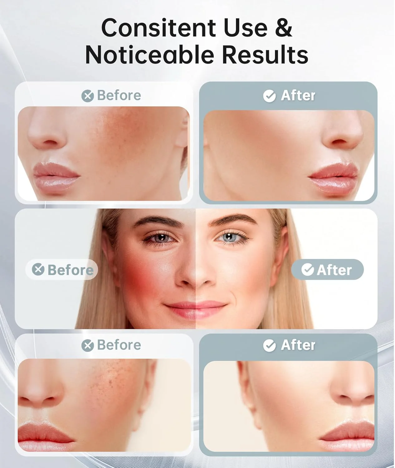 Herbionyx Thermal Vibrating Face Massager