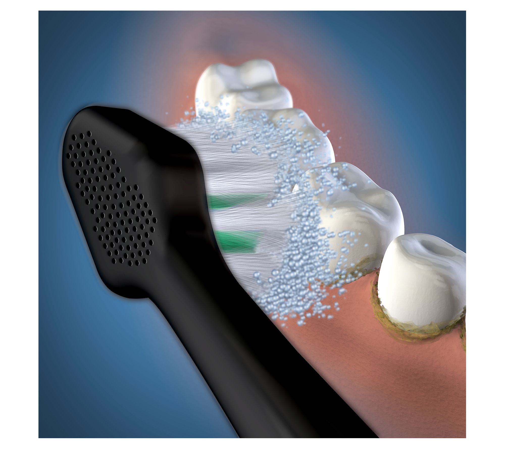 Waterpik Complete Care 5.0 Replacement Brush Heads