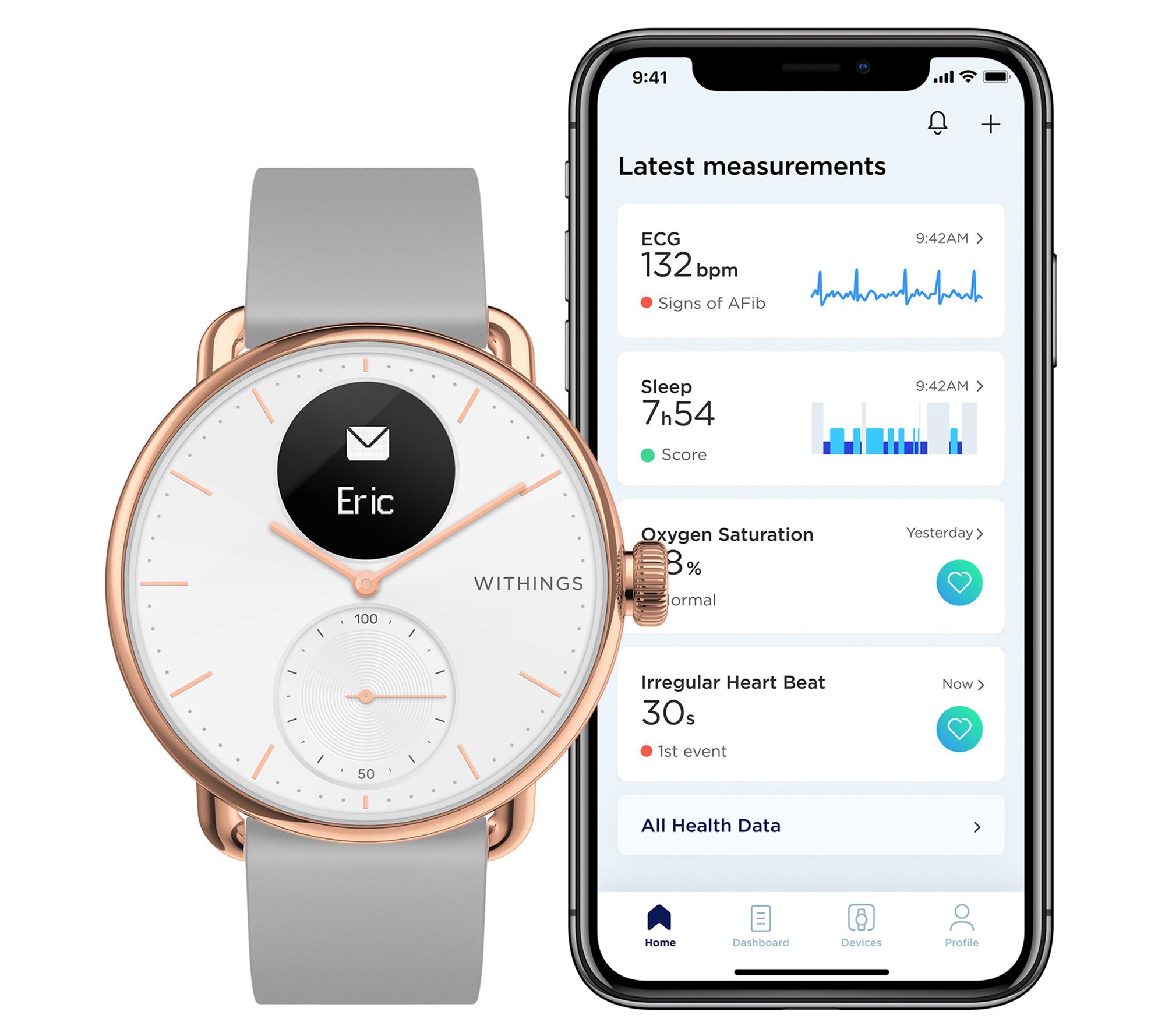 Withings ScanWatch 38mm Luxury Smartwatch
